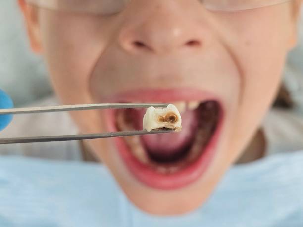 Best Emergency Treatment for Toothache in Hardinsburg, KY